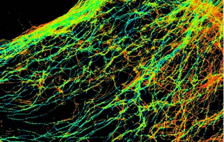 SETAFluorescence Lifetime Dyes copy.jpg